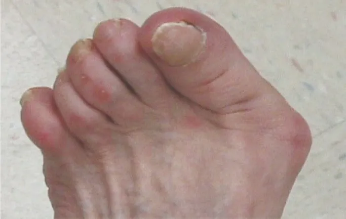 一生歩く足を守る！正しい靴選びのポイント