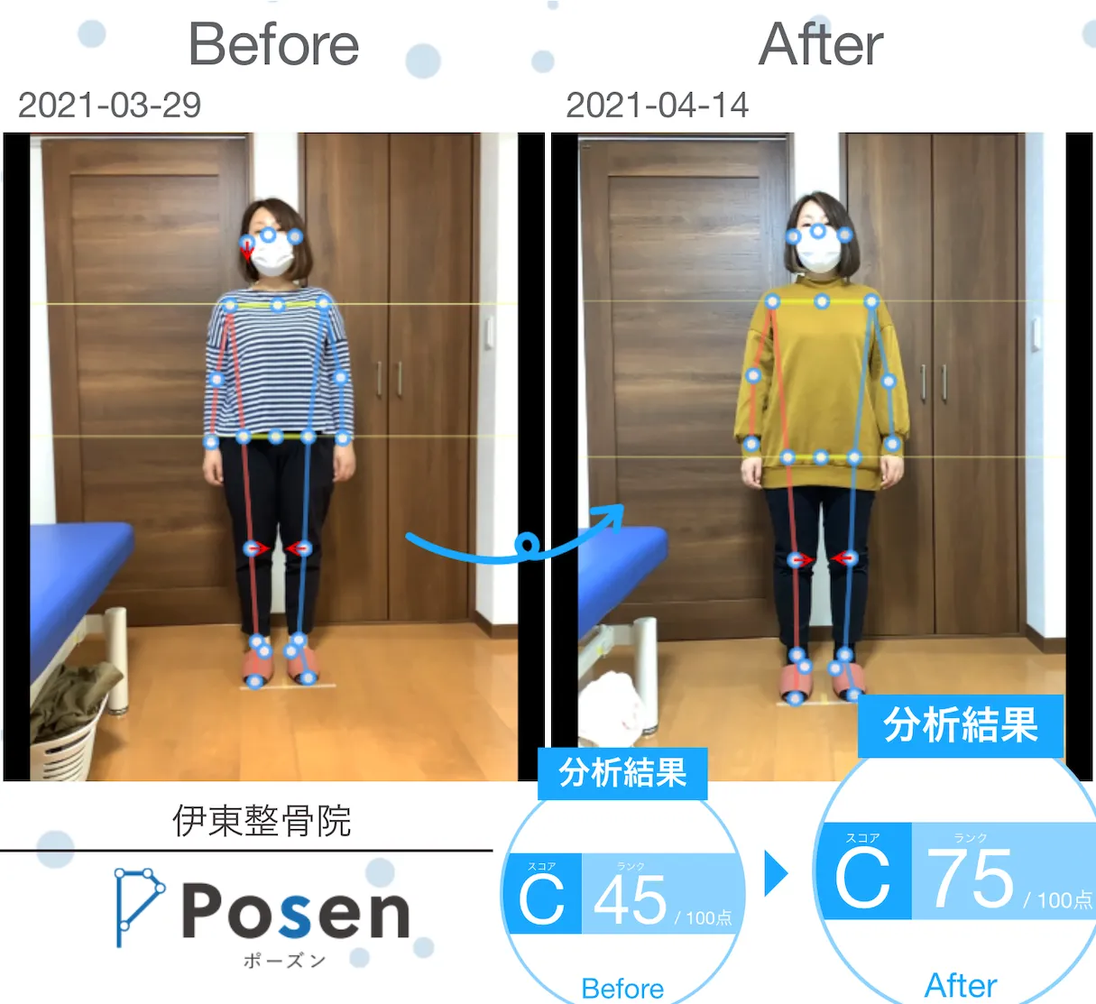 冬の姿勢が春の不調を決める？今こそ整えたい体の歪み